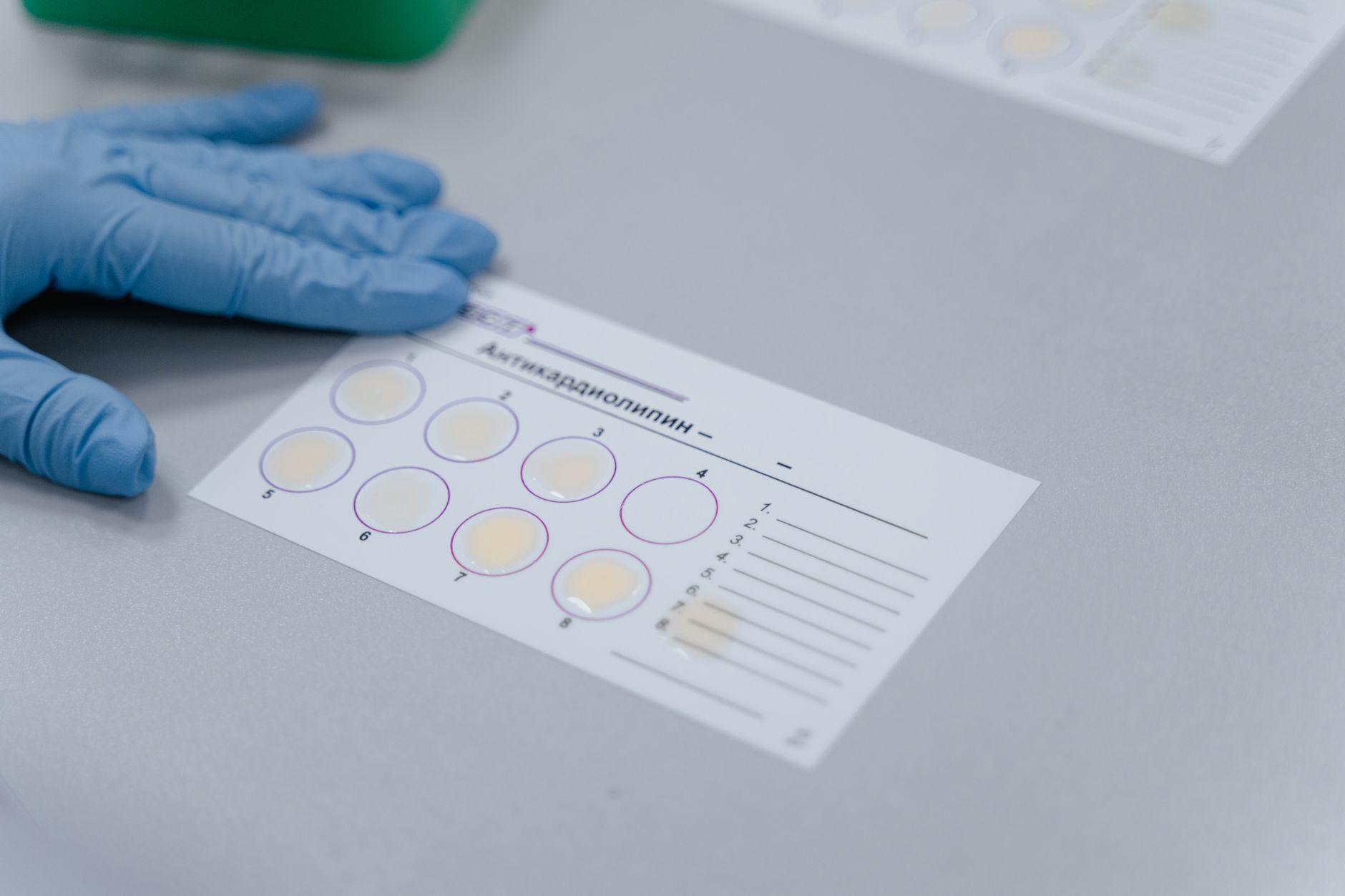Rossari Biotech Q2 results: Honest Insights and Analysis